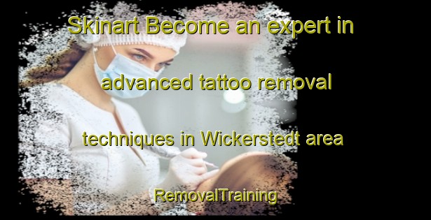 Skinart Become an expert in advanced tattoo removal techniques in Wickerstedt area | RemovalTraining | RemovalClasses | SkinartTraining-Germany
